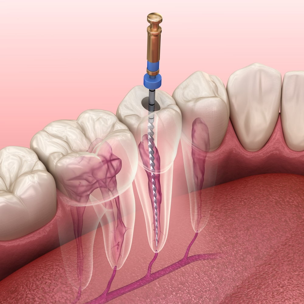 Dentist in Jaipur