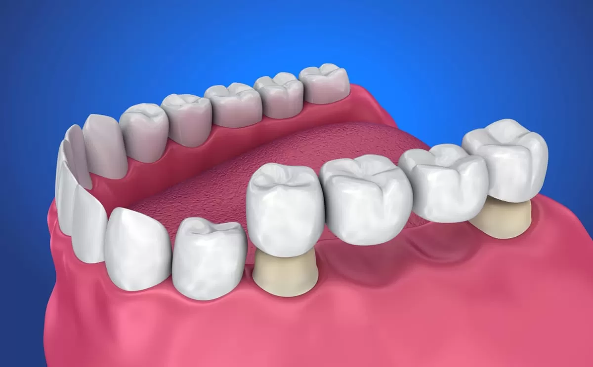 Dentist in Jaipur