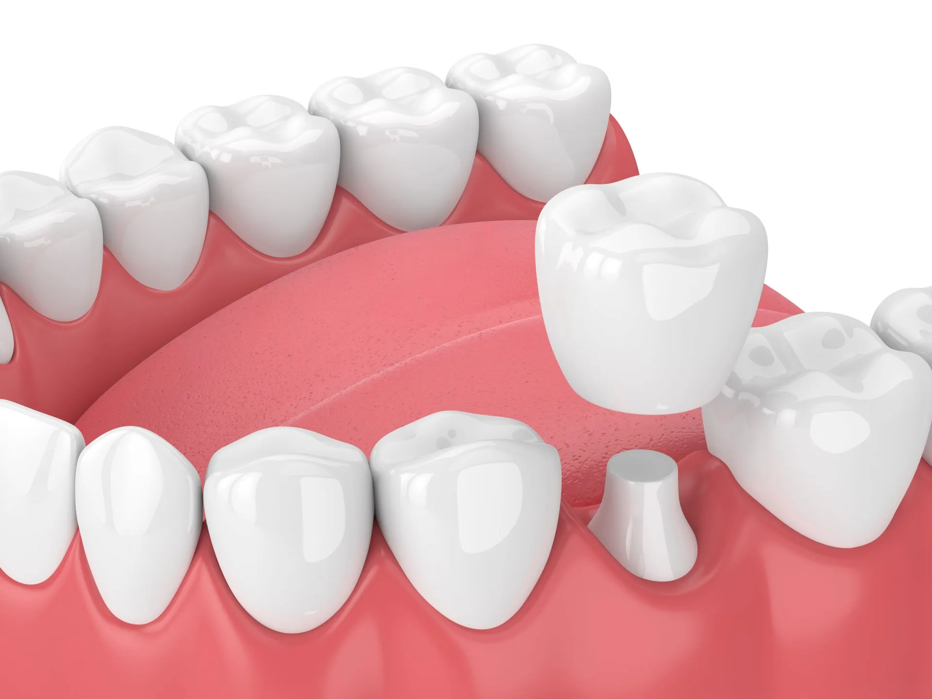Dentist in Jaipur