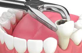 Dentist in Jaipur