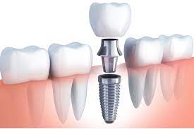 Dentist in Jaipur