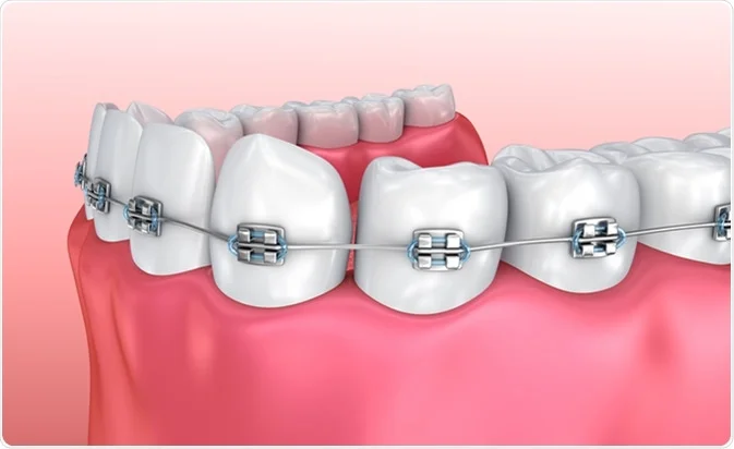 Dentist in Jaipur