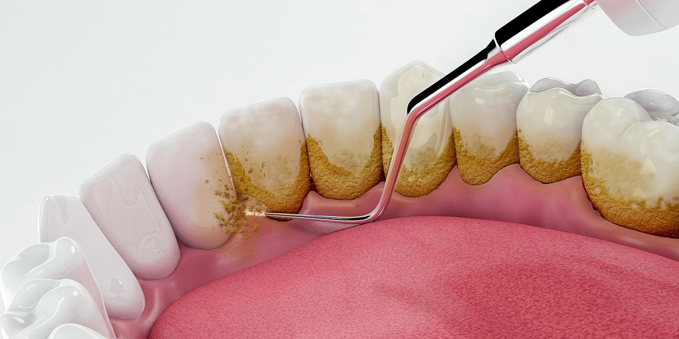 Dentist in Jaipur