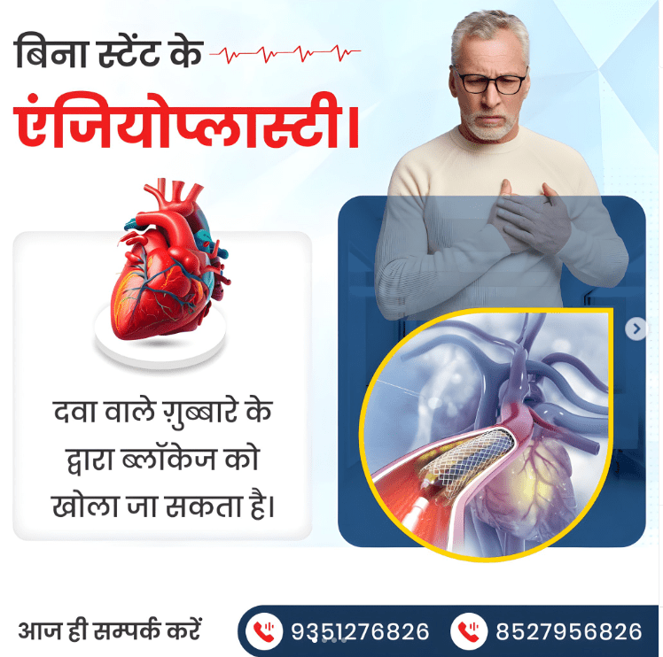 बिना स्टेंट के एंजियोप्लास्टी दवा वाले ग़ुब्बारे के द्वारा ब्लॉकेज को खोला जा सकता है।