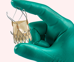 TAVI Doctor in Chandigarh