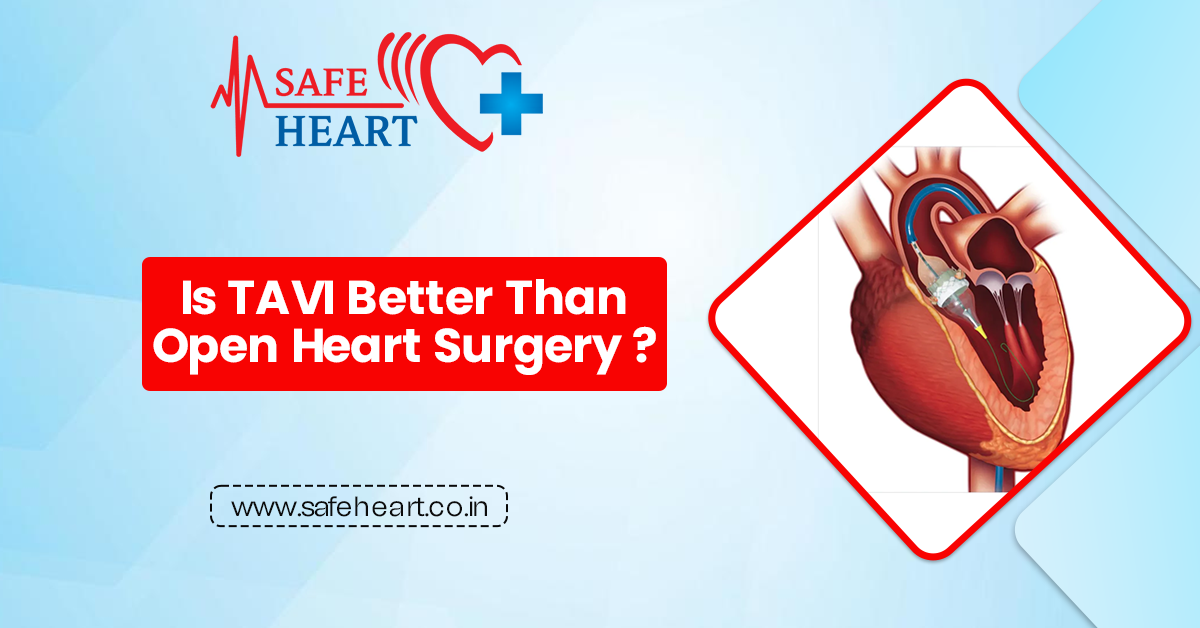 Is TAVI Better Than Open Heart Surgery?