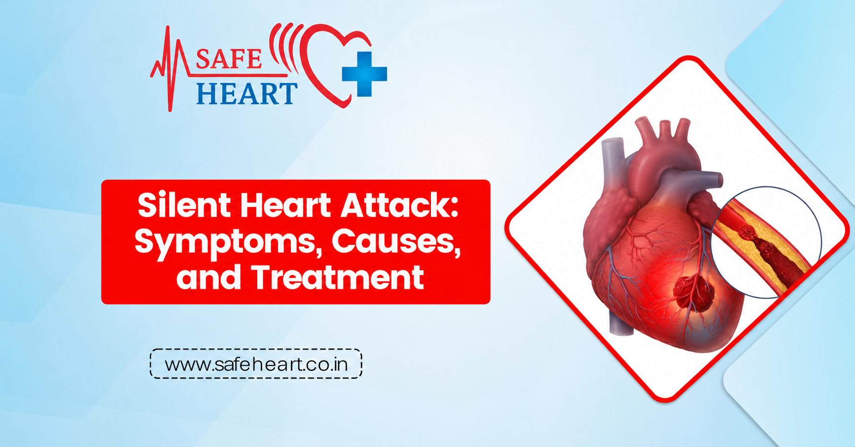 Silent Heart Attack: Symptoms, Causes, and Treatment