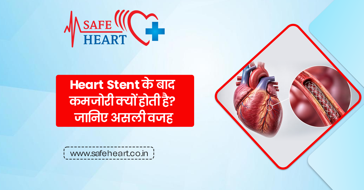 Heart Stent के बाद कमजोरी क्यों होती है? जानिए असली वजह